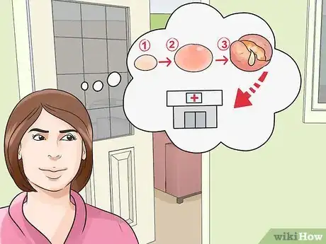Imagen titulada Get Rid of a Cyst Step 1