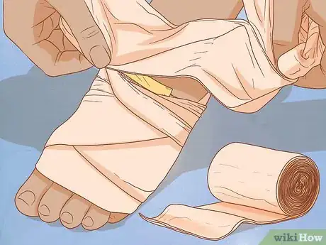Imagen titulada Apply Different Types of Bandages Step 9