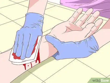Imagen titulada Treat a Dog Bite Step 12