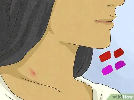 Imagen titulada Identify a Hickey Step 3