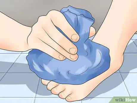 Imagen titulada Tell if a Fall Broke Bones Without an X Ray Step 15