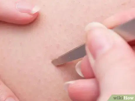 Imagen titulada Prevent Ingrown Hairs on Your Legs Step 12