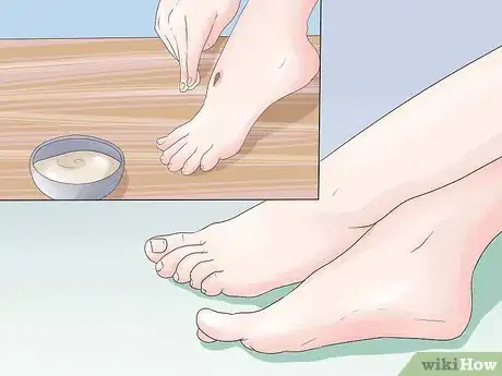 Imagen titulada Get Rid of a Scab Step 16