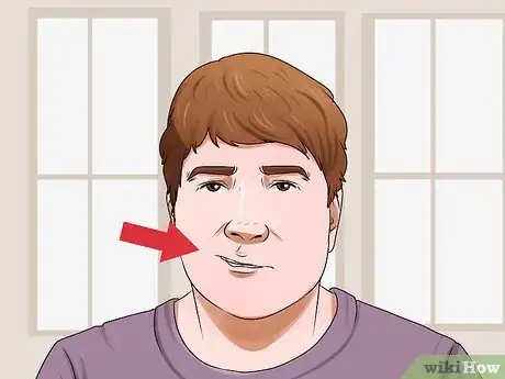 Imagen titulada Respond to a Stroke Step 2