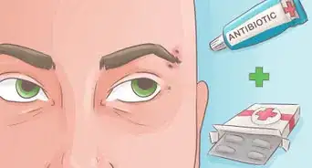 curar los piercings
