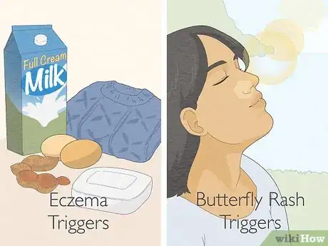 Imagen titulada Tell Eczema from Butterfly Rash Step 2