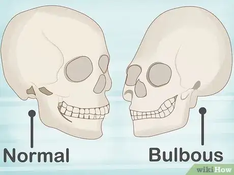Imagen titulada Identify Human Bones Step 1