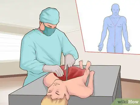Imagen titulada Perform an Autopsy on a Human Being Step 8