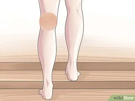 Imagen titulada Know if You Have a Baker's Cyst Step 4