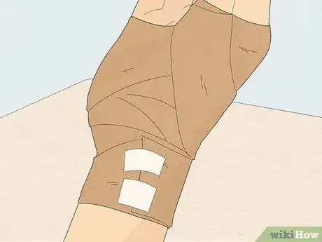 Imagen titulada Wrap a Sprained Thumb Step 11