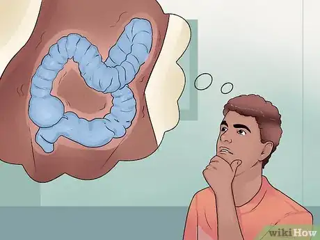 Imagen titulada Distinguish Ulcerative Colitis from Similar Conditions Step 8