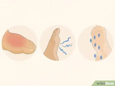Imagen titulada Deal with Foot Cramps Step 17