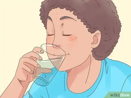 Imagen titulada Remove the Redness of a Pimple Step 18
