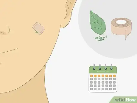 Imagen titulada Get Rid of Warts Step 21
