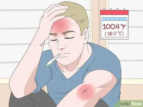 Imagen titulada Remove Glass from a Wound Step 10