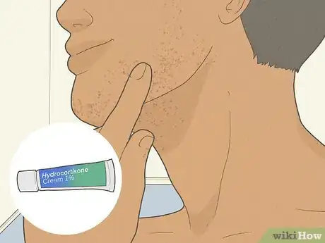 Imagen titulada Get Rid of Razor Burn Fast Step 16