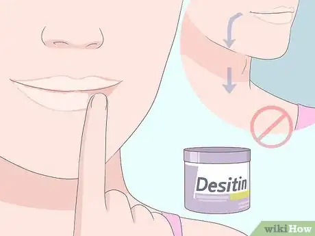 Imagen titulada Cure Angular Cheilitis Step 4