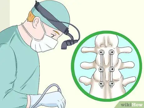 Imagen titulada Straighten Your Spine Step 15