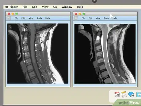 Imagen titulada Read an MRI Step 7