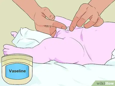 Imagen titulada Clean a Circumcision Step 5