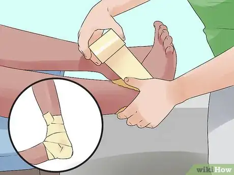 Imagen titulada Tape an Ankle Like an Athletic Trainer Step 6