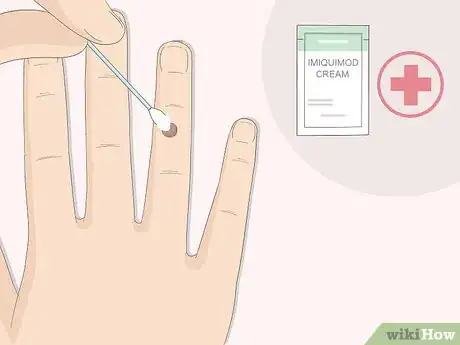 Imagen titulada Get Rid of Warts Step 10