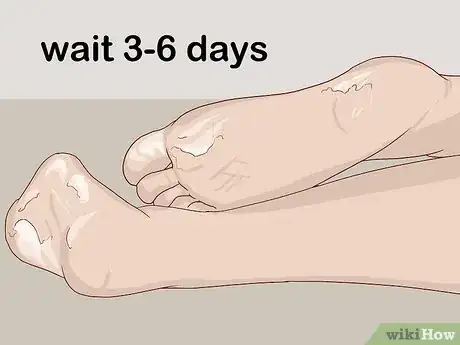 Imagen titulada Use an Exfoliating Foot Peel Step 10