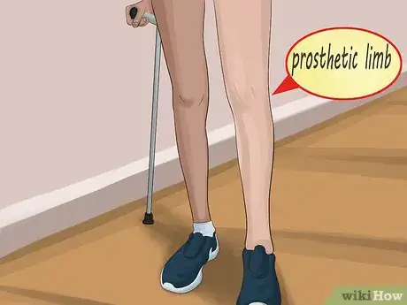 Imagen titulada Wear a Prosthesis Step 3