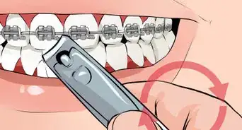 reparar los alambres rotos de tus brackets
