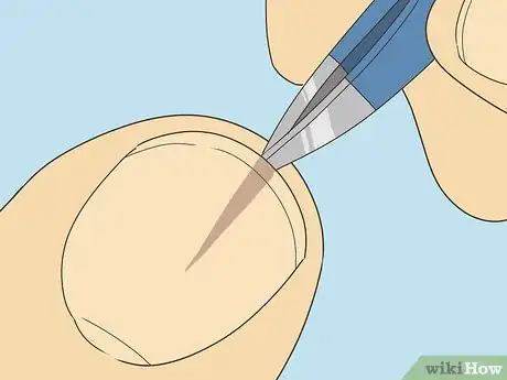 Imagen titulada Remove a Splinter Under Your Fingernail Step 3