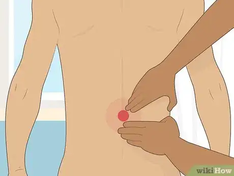 Imagen titulada Untrap a Nerve in Your Lower Back Step 16