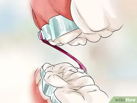Imagen titulada Connect a Rubber Band to Your Braces Step 4