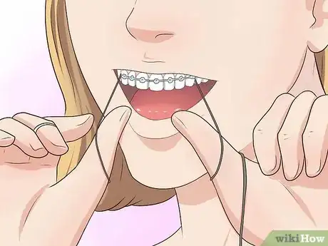 Imagen titulada Make Your Braces Hurt Less Step 4