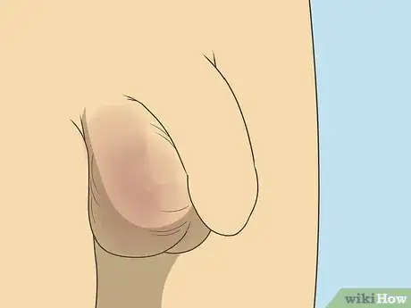 Imagen titulada Tell if You Have Hit Puberty (Boys) Step 2