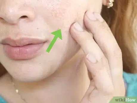 Imagen titulada Improve Your Facial Skin Step 6