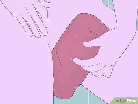 Imagen titulada Treat Vaginal Cysts Step 8