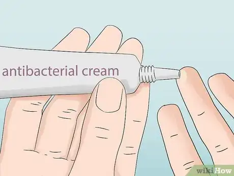 Imagen titulada Stop Armpit Pimples Step 12