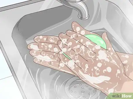 Imagen titulada Remove Pus from a Wound Step 1