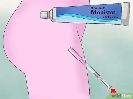 Imagen titulada Soothe Itching from Thrush Step 1
