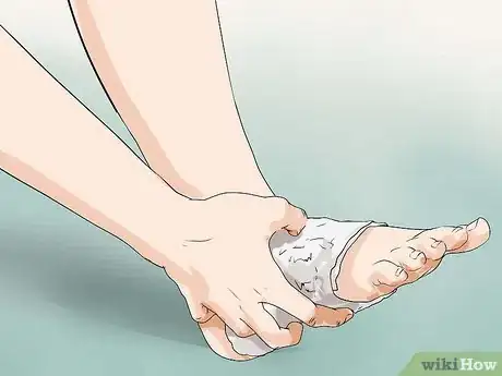 Imagen titulada Prevent the Spread of Fungal Infections Step 6