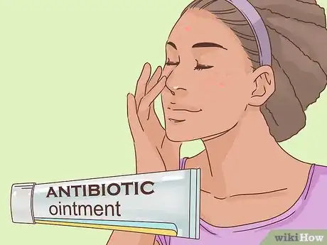 Imagen titulada Get Rid of a Popped Pimple Overnight Step 2