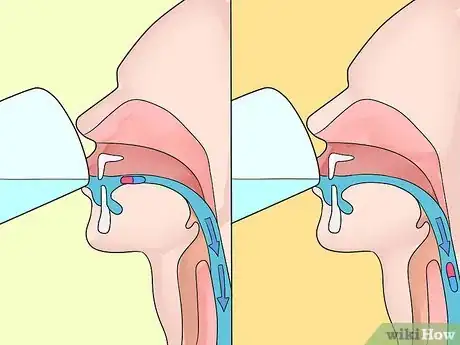 Imagen titulada Swallow a Pill Step 8
