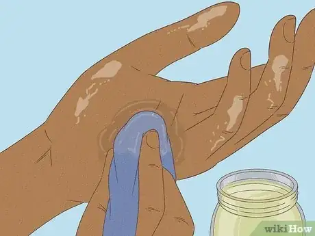 Imagen titulada Get Spray Foam Off Hands Step 9