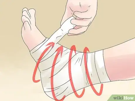 Imagen titulada Tape a High Ankle Sprain Step 7
