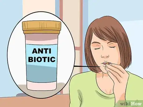 Imagen titulada Treat Cellulitis Step 11