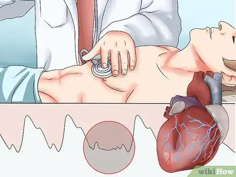 Imagen titulada Take an Apical Pulse Step 13