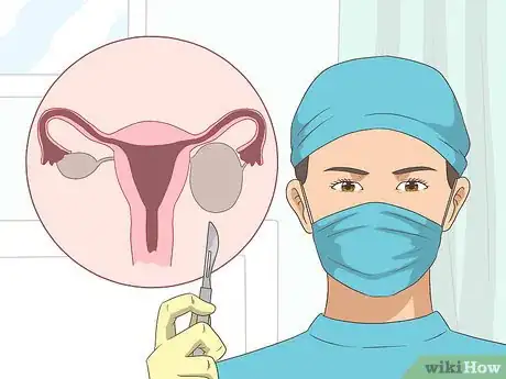 Imagen titulada Shrink Ovarian Cysts Step 8