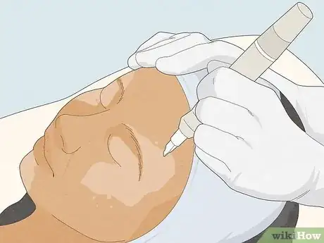 Imagen titulada Cover Vitiligo Patches with Makeup Step 12