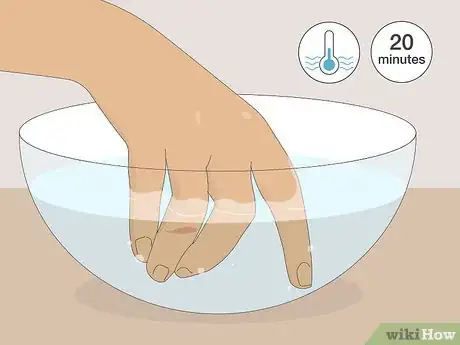 Imagen titulada Deal With the Pain of a Door Being Shut on Your Finger Step 4