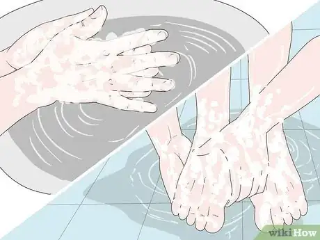 Imagen titulada Remove Splinters from Feet Step 1